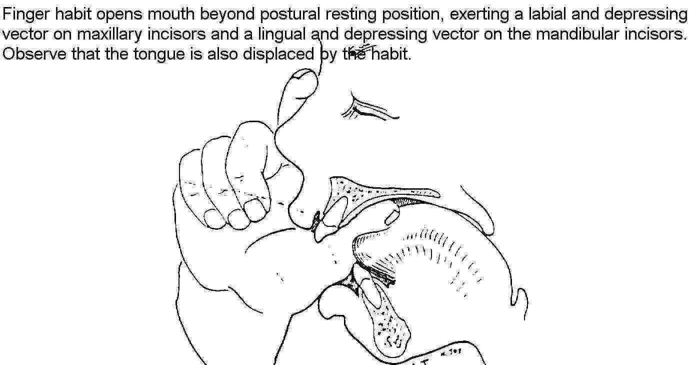 Graphic-vector forces