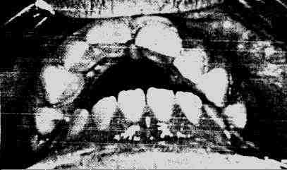 {short description of image}