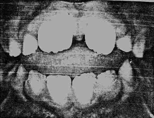{short description of image}