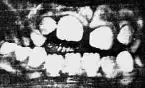 {short description of image}